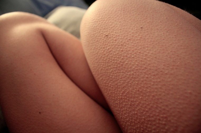 it's-possible-for-corpses-to-get-goosebumps